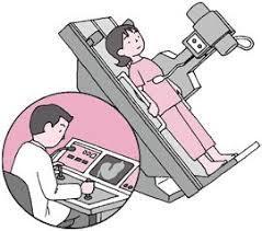 胃バリウム検査のイラスト